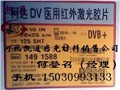 DVB柯達(dá)醫(yī)用膠片  圖片